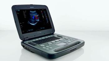 Siemens Acuson P500