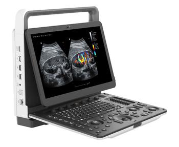 Zoncare M30